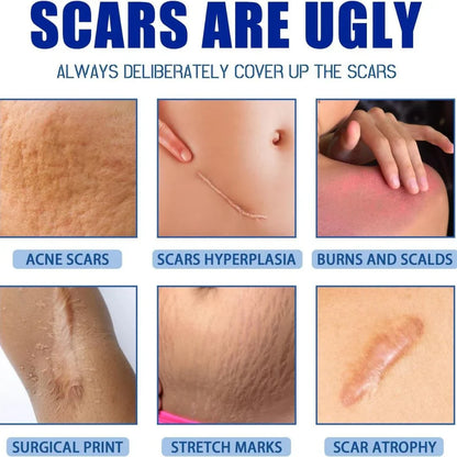 Advanced Silicone Scar Gel and Scar Removal Cream
