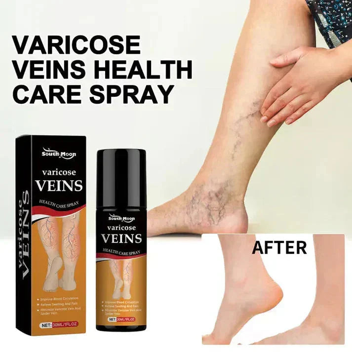 Varicose Veins Spray – Natural Herbal Formula for Fast Relief
