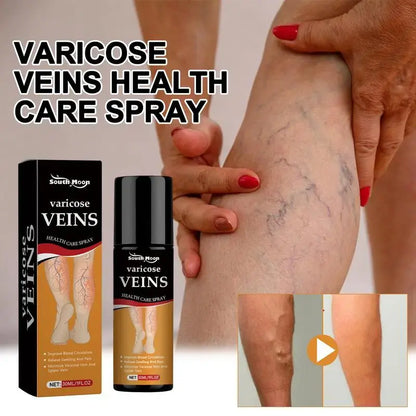 Varicose Veins Spray – Natural Herbal Formula for Fast Relief